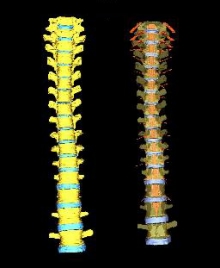 The spine of a human male The spine of a human male